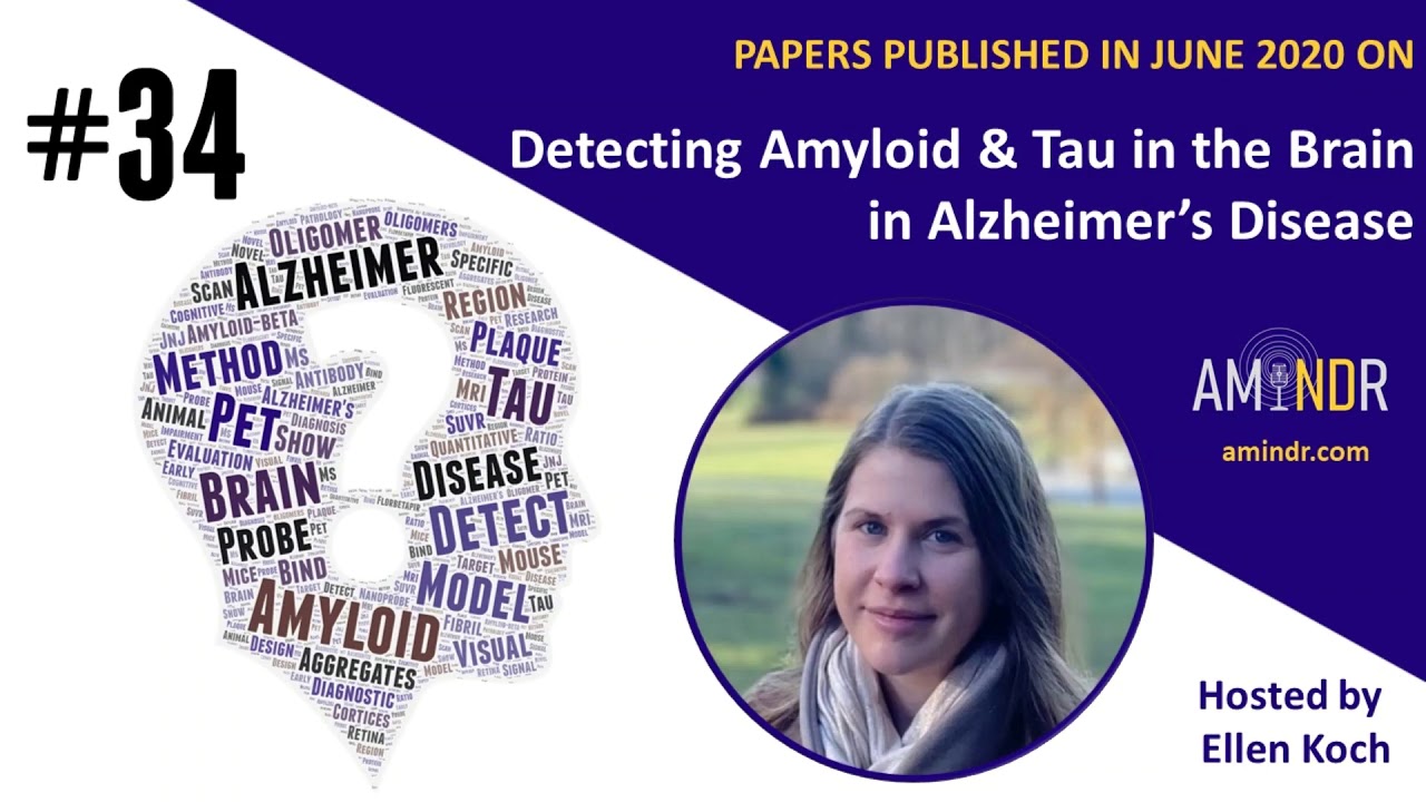 34 - Detecting Amyloid & Tau in the brain: Alzheimer's Disease June 2020 | AMiNDR
