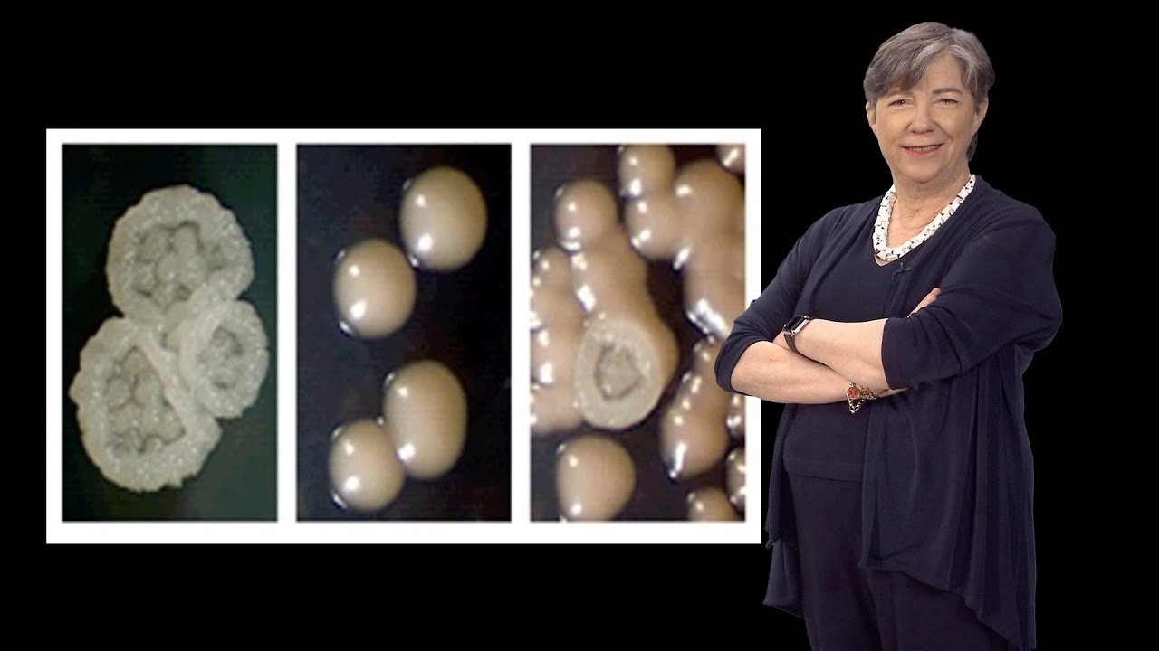 Susan Lindquist (Whitehead, MIT / HHMI) 3: Prions: Protein Elements of Genetic Diversity