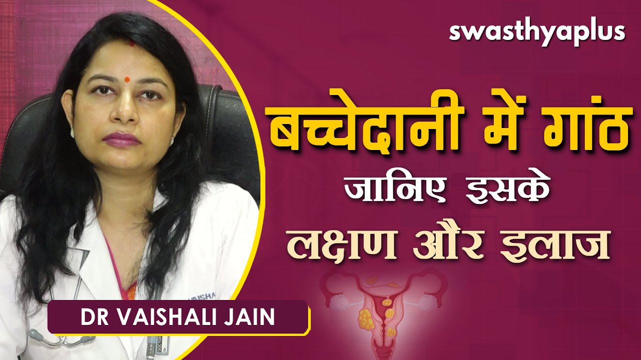 ओवेरियन सिस्ट (अंडाशय में गांठ) - जानें कारण और लक्षण | Dr Vaishali Jain on Ovarian Cyst in Hindi