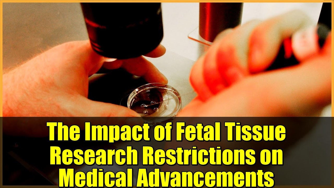 The Impact of Fetal Tissue Research Restrictions on Medical Advancements