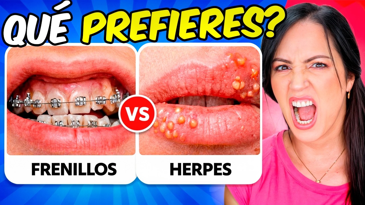 &iquest;QU&Eacute; PREFIERES? 😨 Las 100 Decisiones M&aacute;s Extremas Que Vas a Tener Que Tomar &hearts; Sandra Cires Play