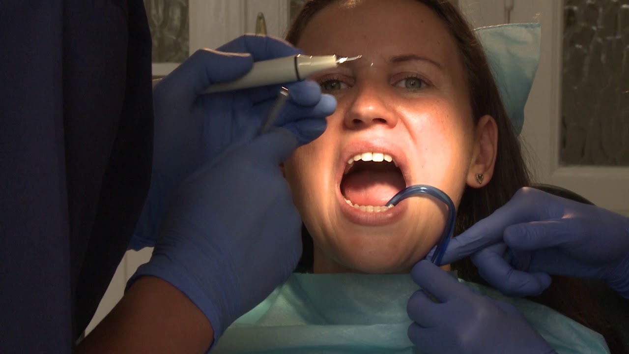 Fogkőleszedés, Harmónia Fogászat   1080p