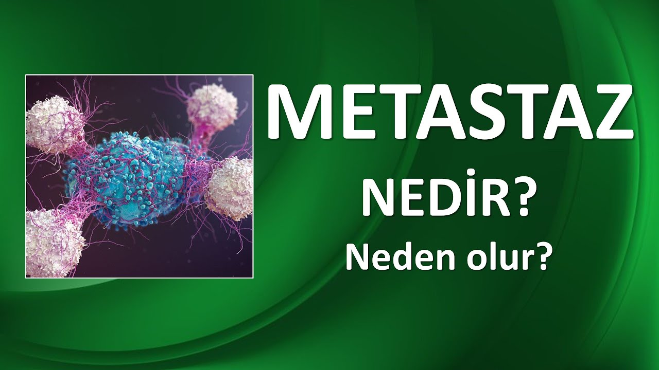 METASTAZ NEDİR?
