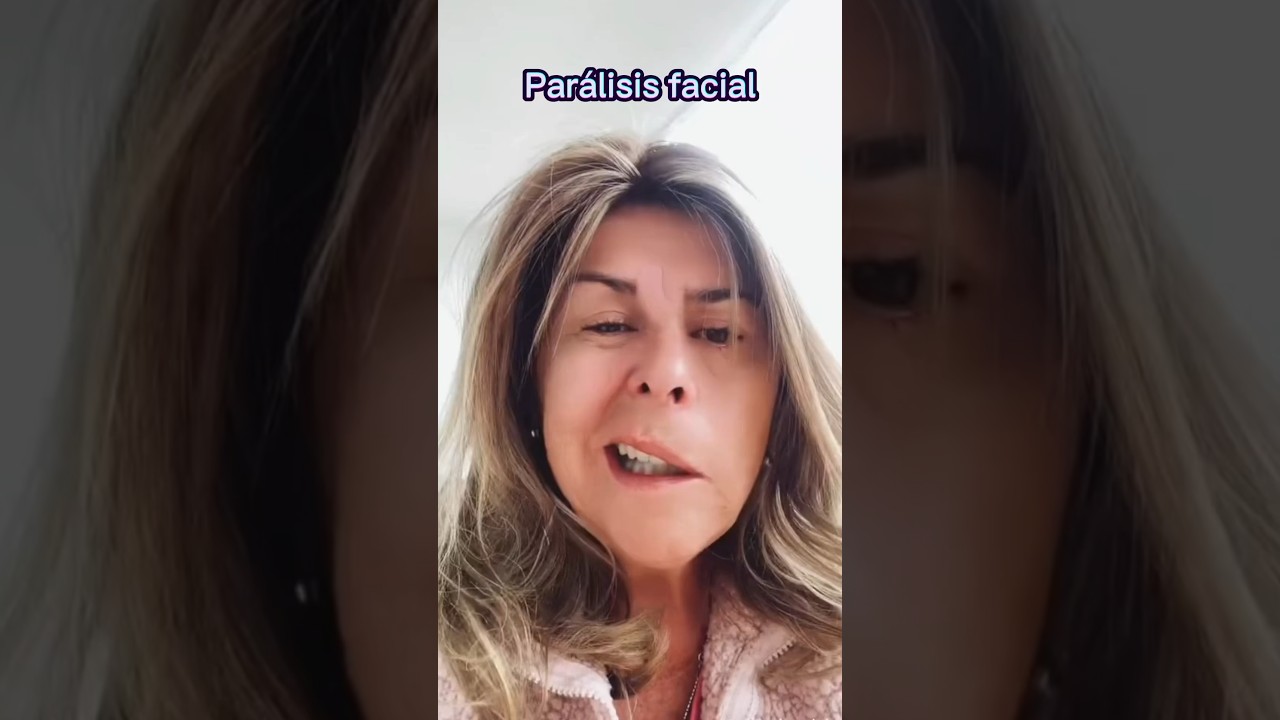 &iexcl;Alerta! Par&aacute;lisis facial, todo lo que debes saber | Dr. William Guerrero. #medicina #shorts
