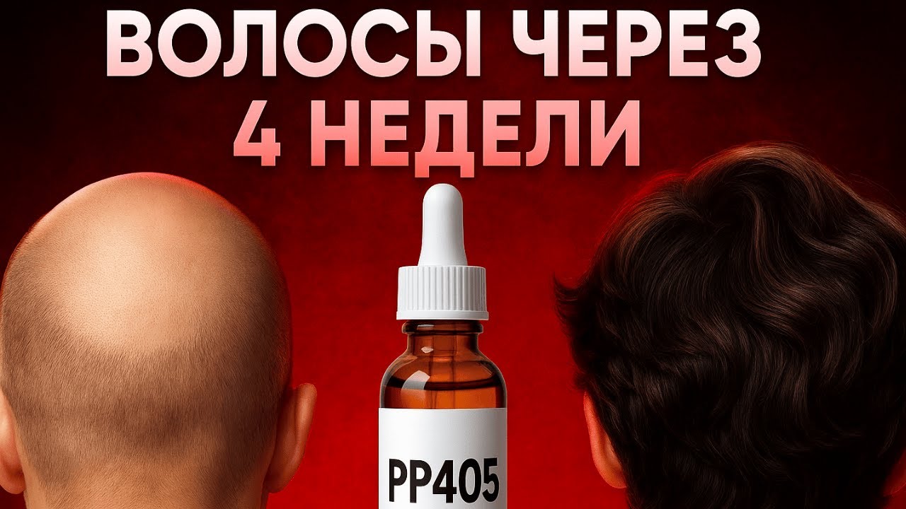 PP405 спасёт от облысения или нет?
