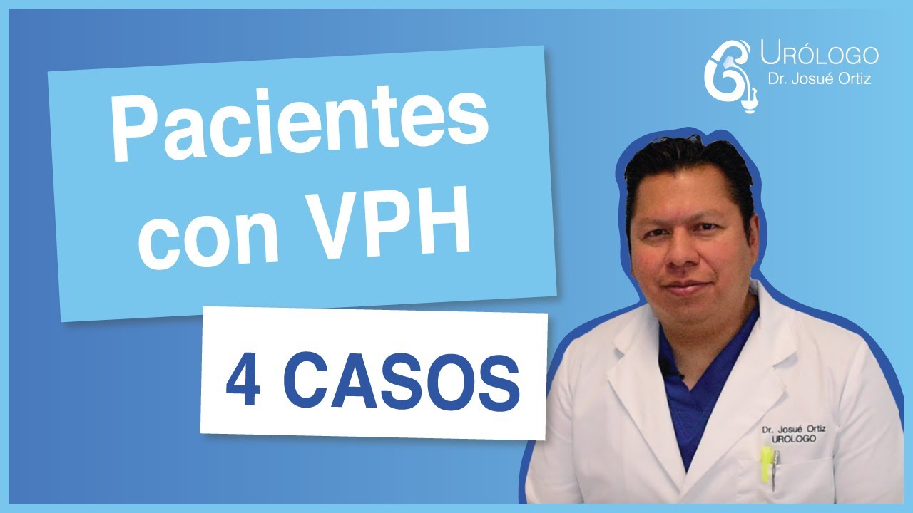 Cuatro CASOS de pacientes con VIRUS DEL PAPILOMA HUMANO - UR&Oacute;LOGO Josu&eacute; Ortiz