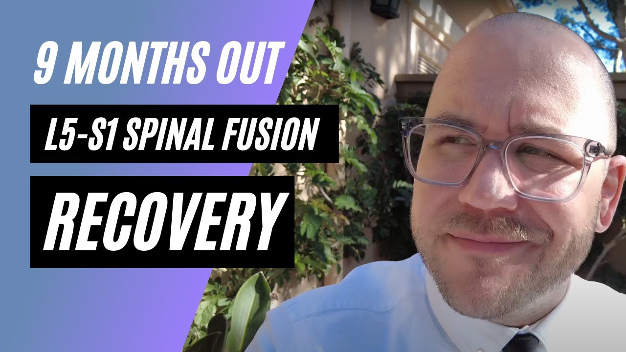 L5-S1 Spinal Fusion Surgery TLIF Recovery (Pars Defect) - 9 Months Post-Op
