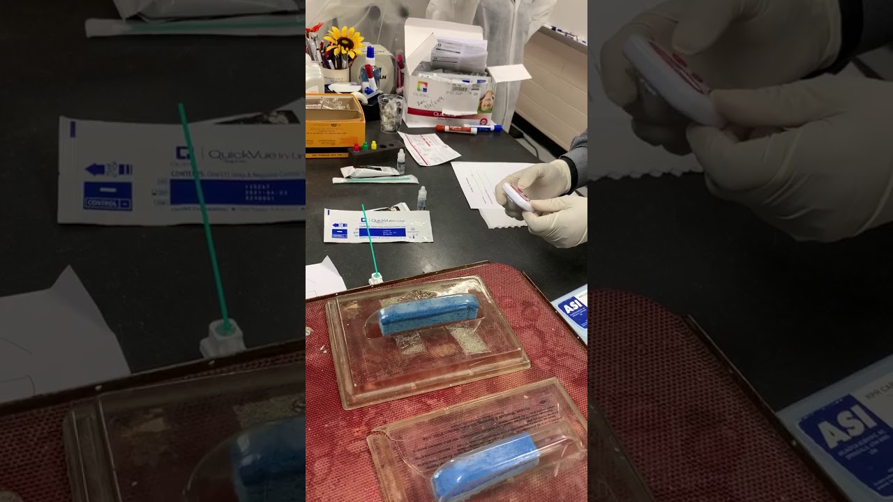 Strep screen