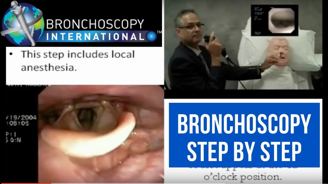 Bronchoscopy Step by Step Walkthrough 1-6