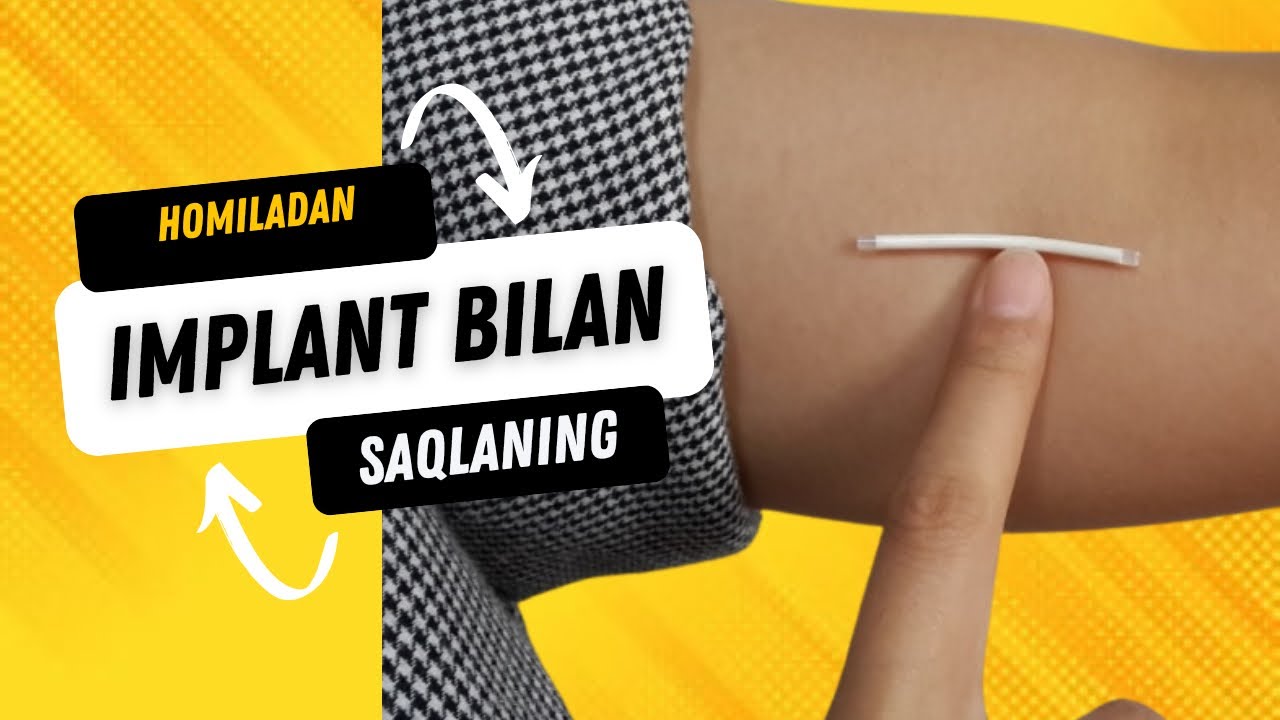 Implant. Homiladan qanday saqlanish kerak?