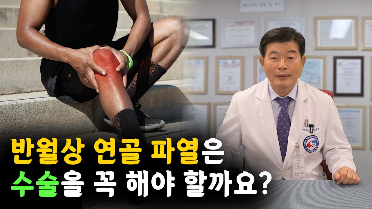 반월상 연골 파열은 수술을 꼭 해야 할까요?