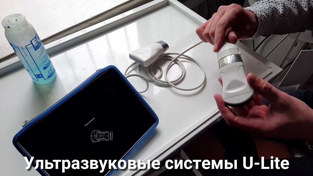 Ставьте диагноз без посредников.  Портативный экспертный УЗИ аппарат. УЗИ суставов