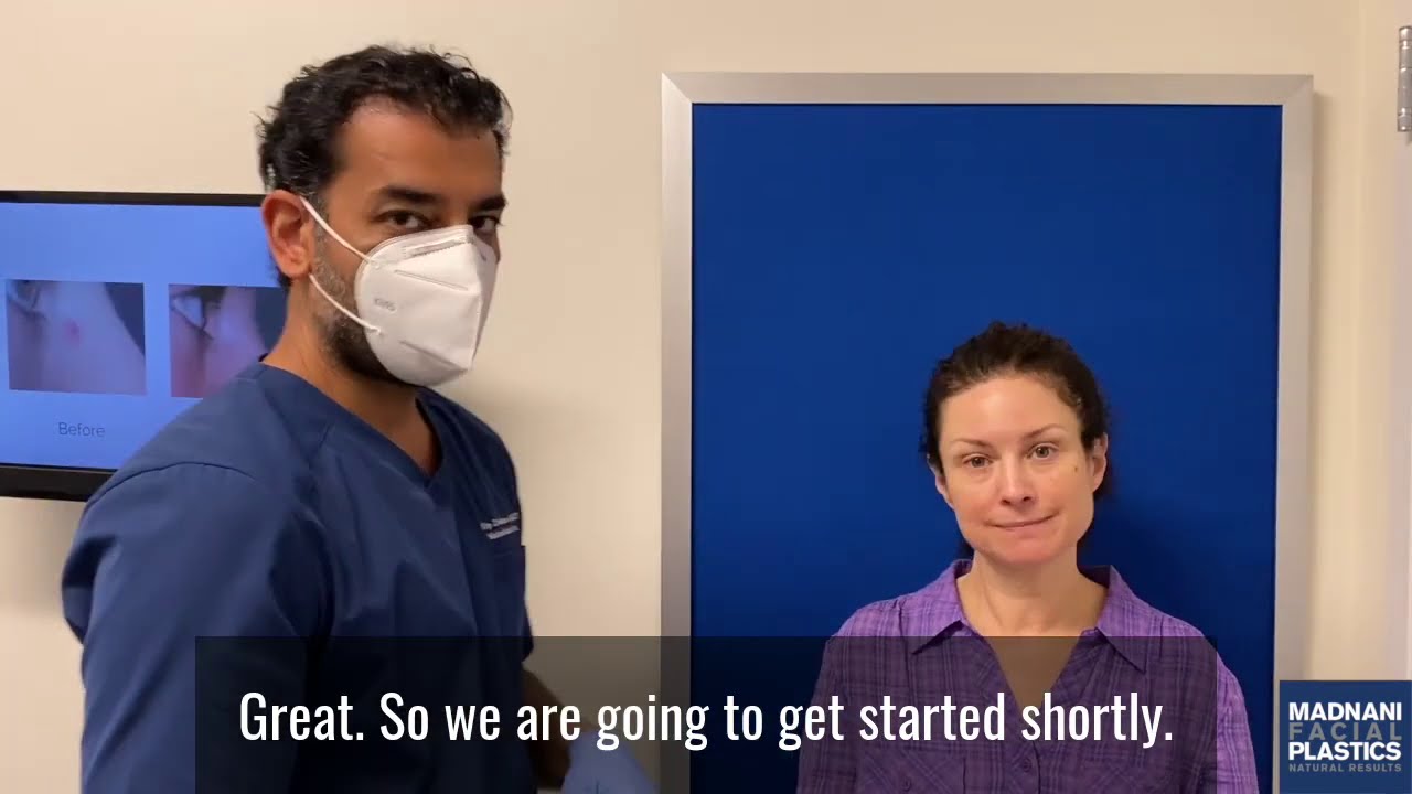 Facelift Patient 1 week & 1 month After!