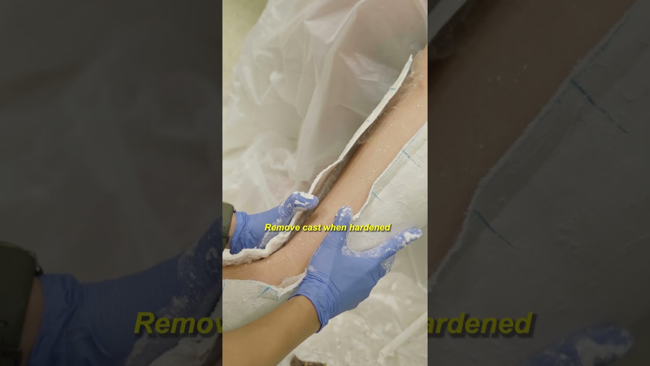Prosthetics and Orthotics Workshop ASMR #workshop #asmr #hospital