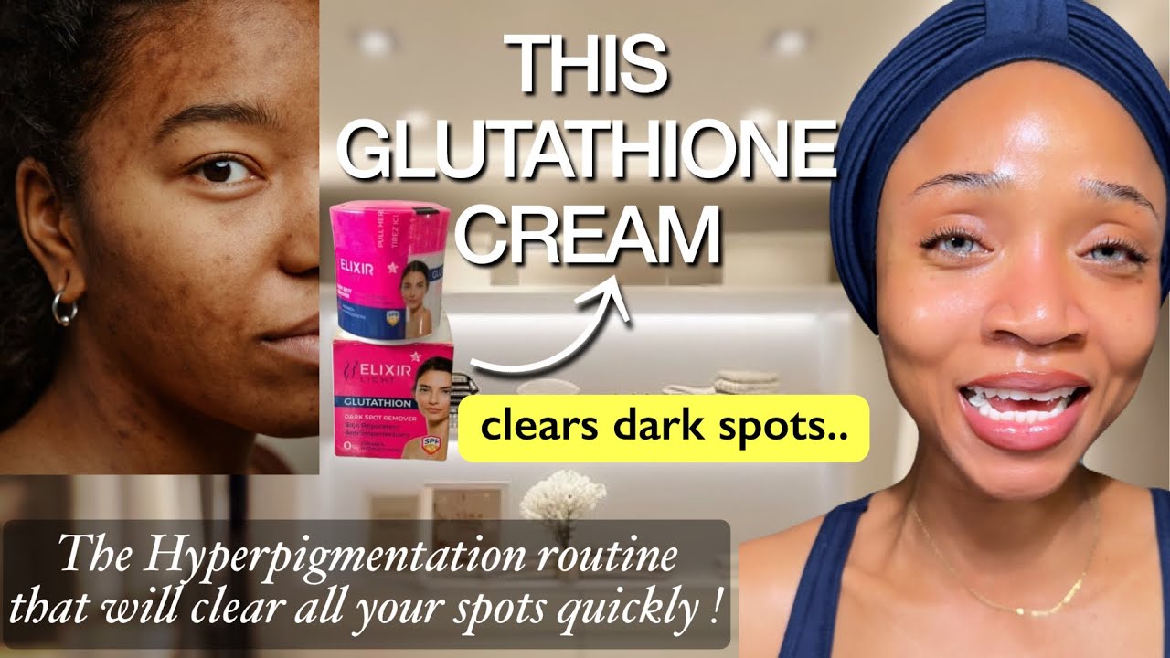 The only video you need to watch to get rid of DARK SPOTS fast! ( Fully in-depth )