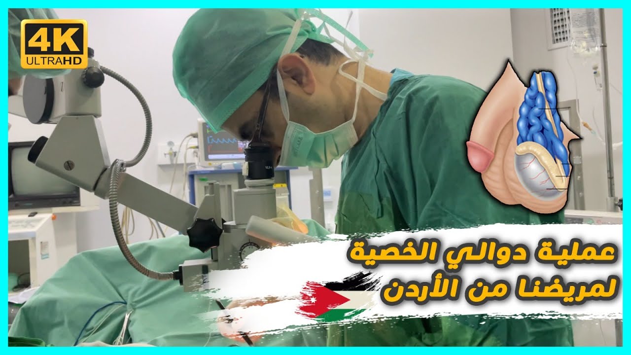 عملية دوالي الخصية (بإستخدام تقنية الميكروسكوب وتقنية الدوبلر) لمريضنا من الأردن 🇯🇴