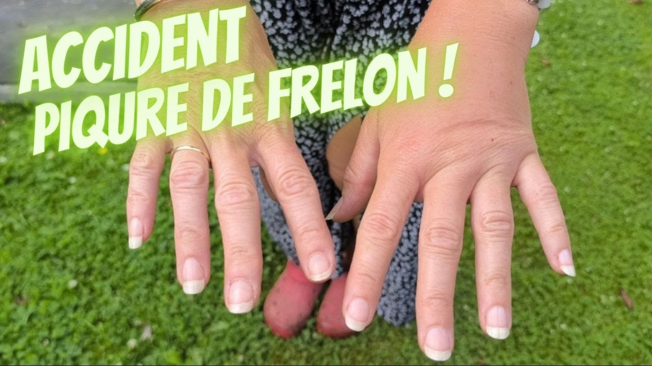 Frelon asiatique dans une jarre, ACCIDENT:  piqure à la main