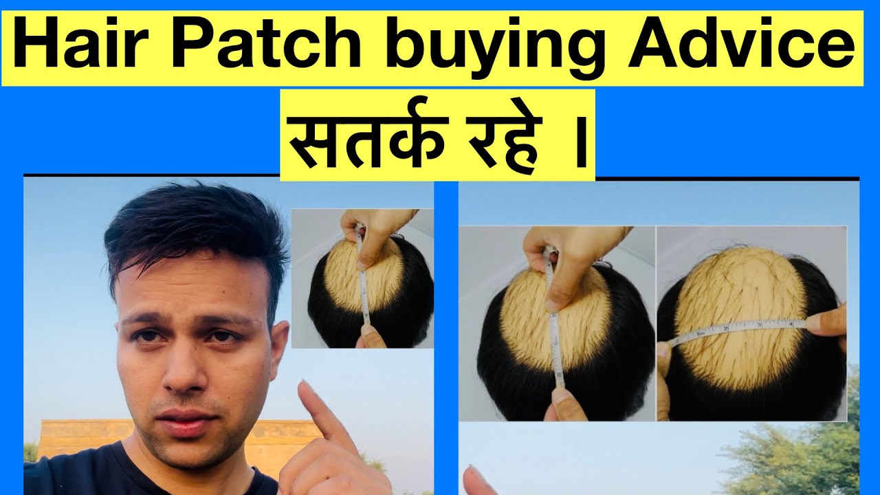 Hair patch buying guidance || Hair patch awareness