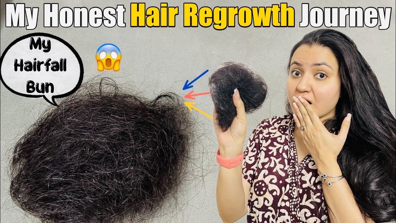 My Hair Loss & Hair Regrowth Journey | Sharing My Story❤️
