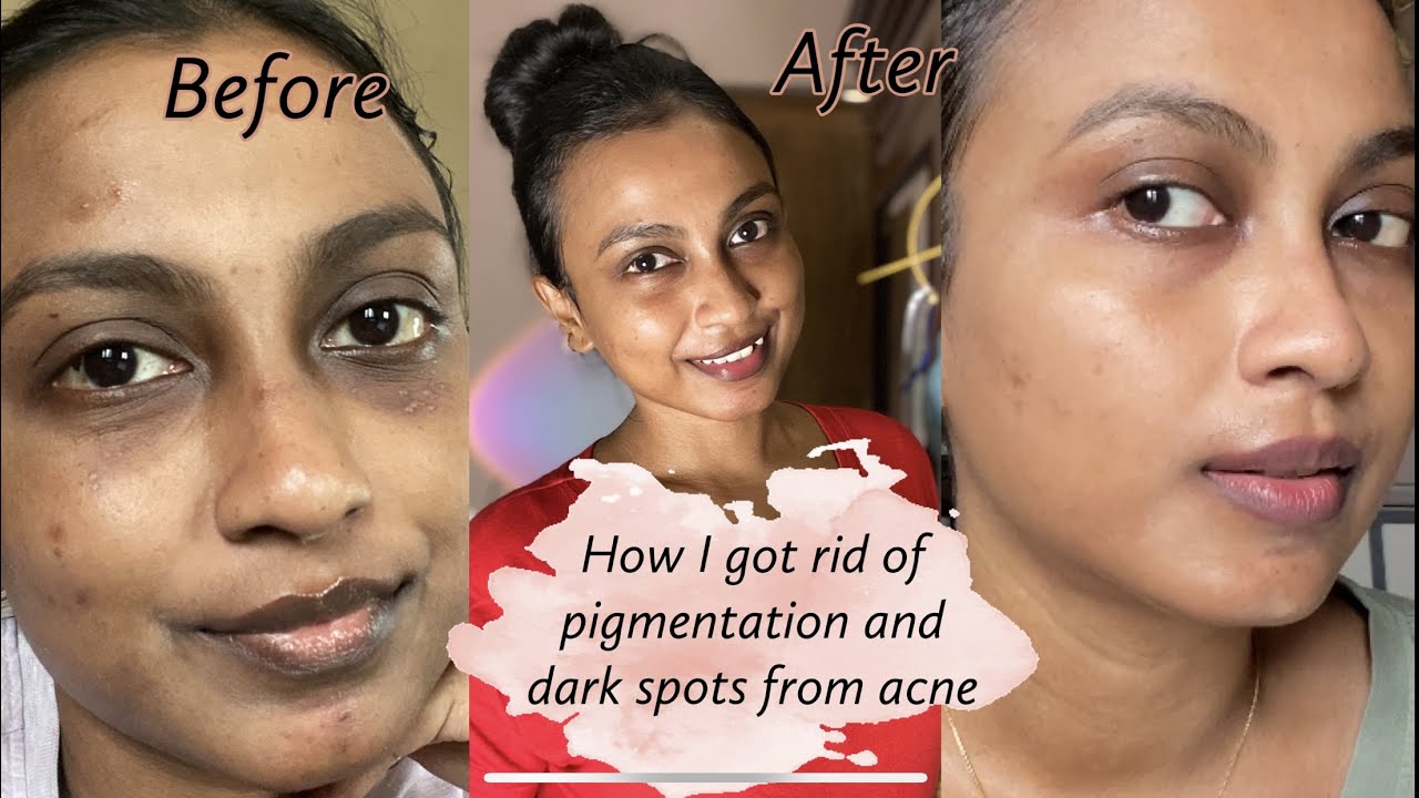 Unsponsored Skincare Routine - Truth Behind Sponsored Videos