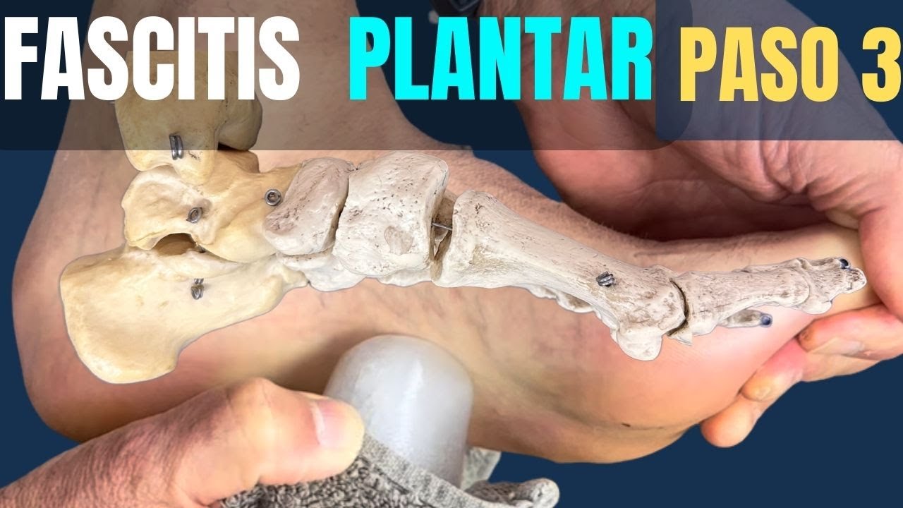 🧊❄️👣 ¡Dile Adiós al Dolor! Desinflama Fascitis y Espolón en SOLO Minutos