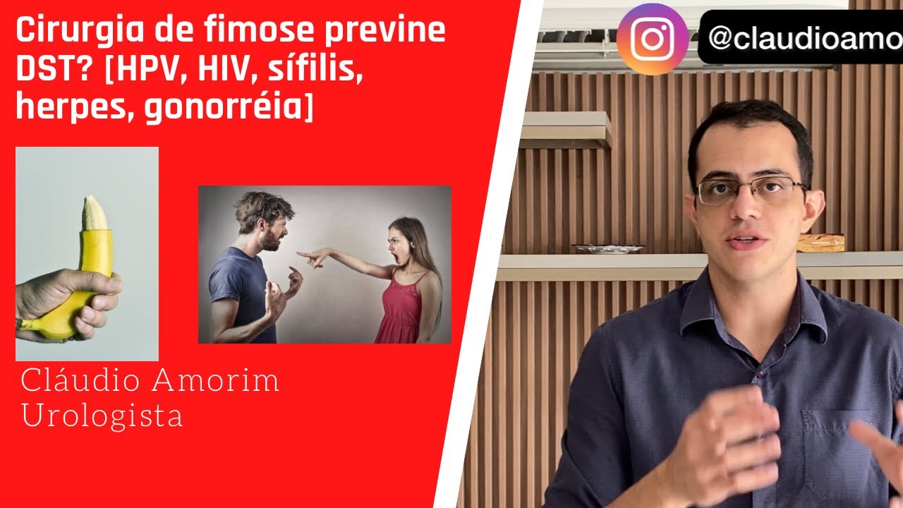 Cirurgia de fimose previne DST? [HPV, HIV, s&iacute;filis, herpes, gonorr&eacute;ia] [Postectomia, circuncis&atilde;o]