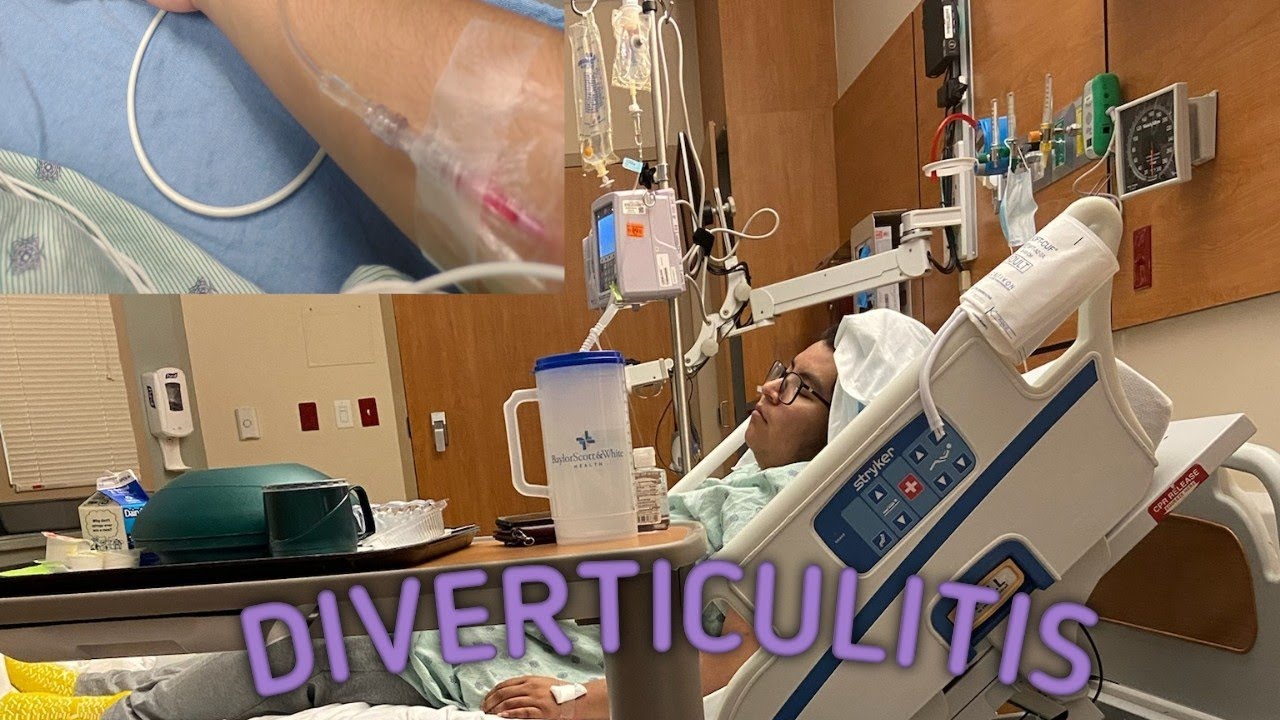 My Diverticulitis story