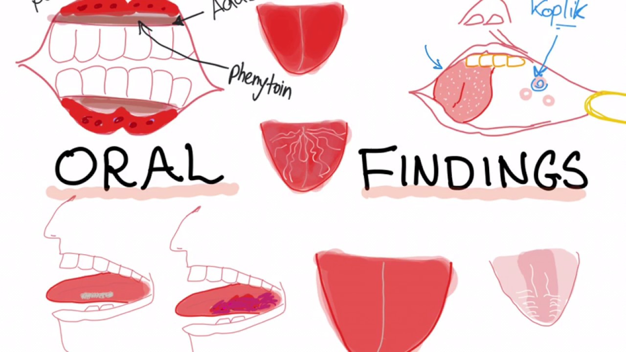 Oral lesions and diseases associated with them