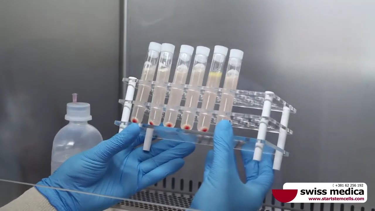 Stem Сells Treatment Procedure: Adipose Tissue And Bone Marrow