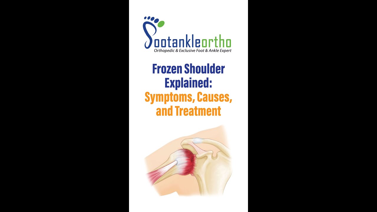 Frozen Shoulder Explained: Symptoms, Causes, and Treatment