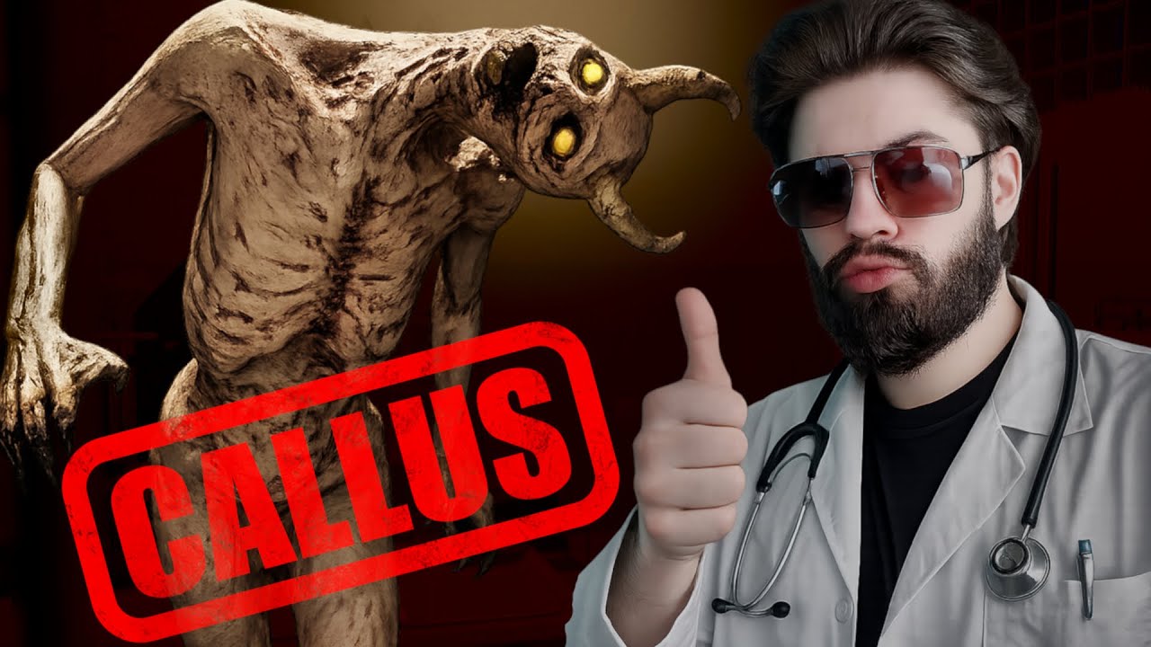 СПЕЦ ПО МОЗОЛЯМ !!! - CALLUS !!!