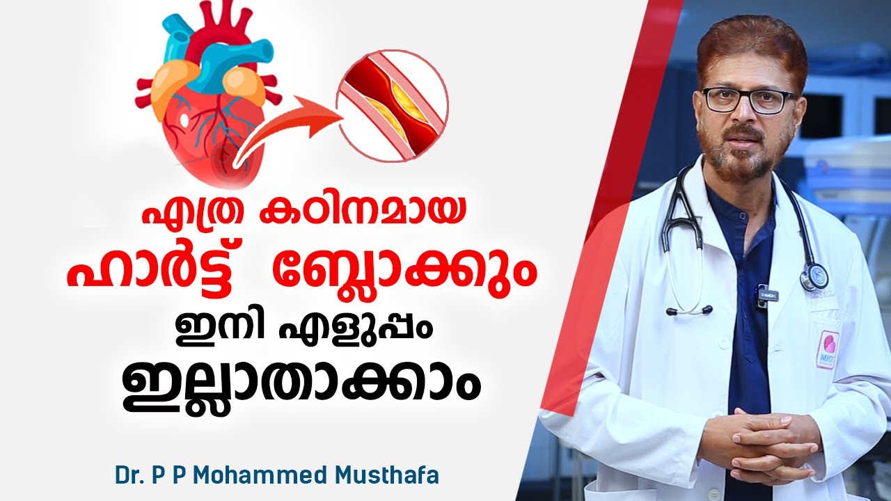 എത്ര കഠിനമായ ഹാർട്ട്  ബ്ലോക്കും ഇനി എളുപ്പം ഇല്ലാതാക്കാം | Heart block Treatment | Rotablation