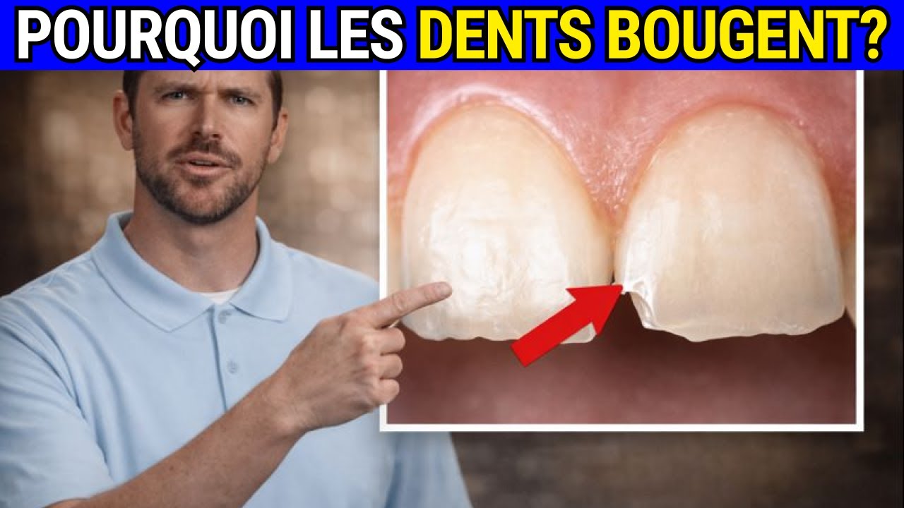 Vos dents bougent sans raison: 5 causes cachées à connaître d’urgence