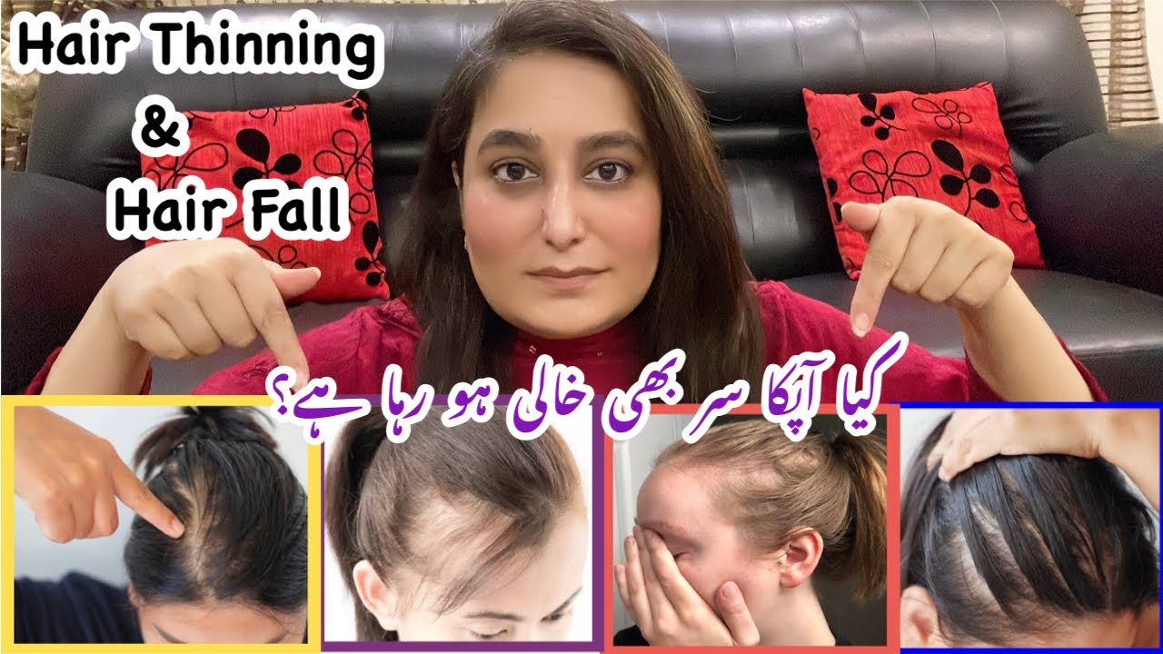 How I Treated My Thinning Hair The Holistic Way|Haircare Routine To Stop HairFall & Hair Thinning