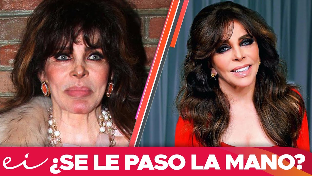 Verónica Castro Análisis Antes y Después | Dismorfofobia
