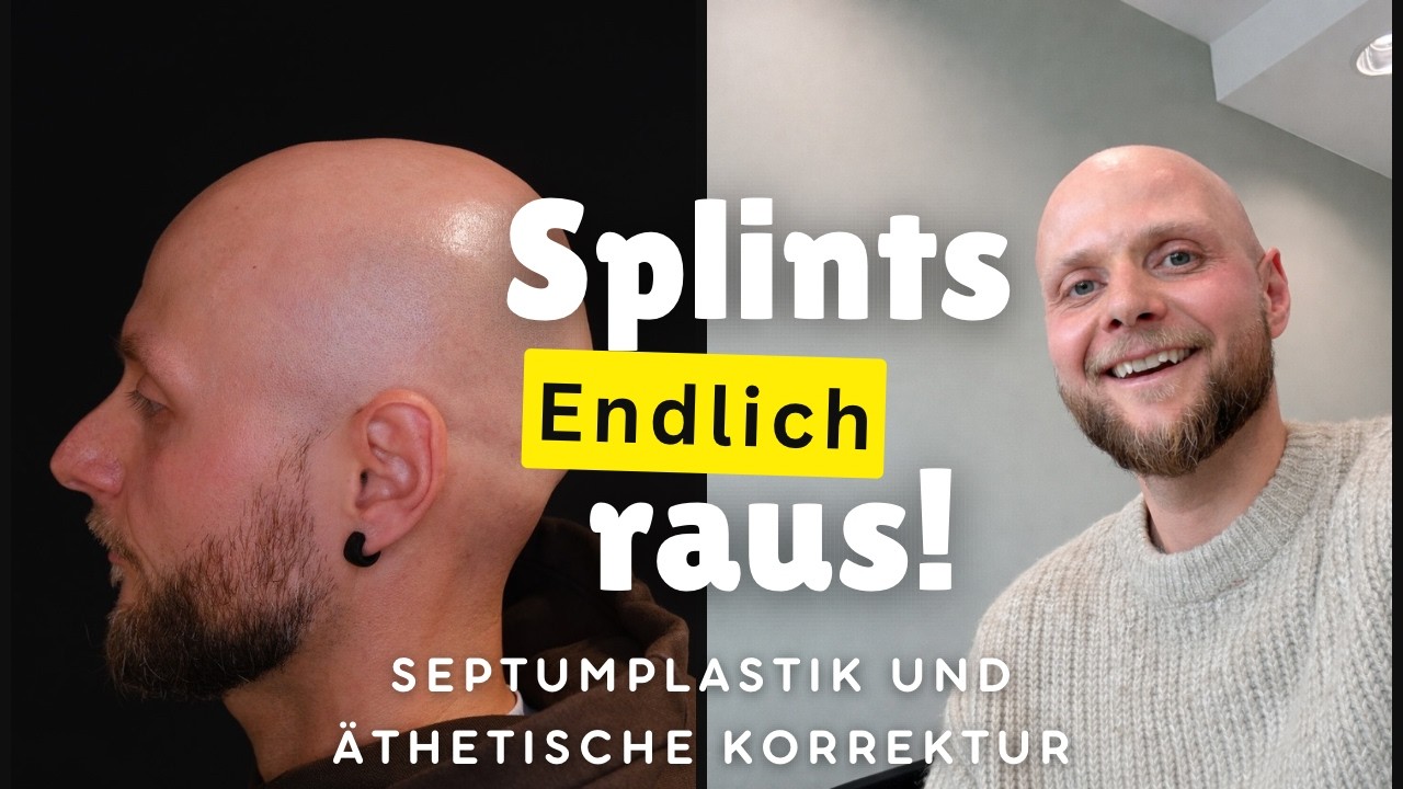 Splints gezogen nach Septumplastik, endlich frei atmen! (Nasen-OP)