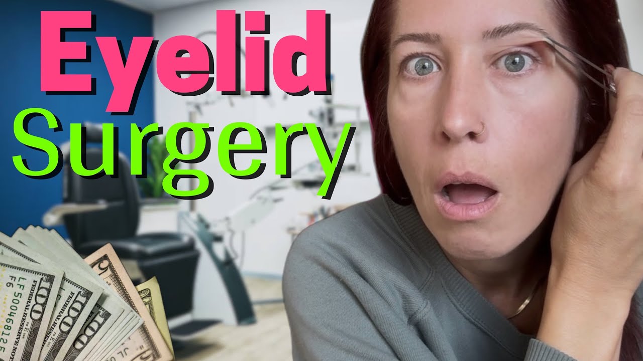 Blepharoplasty Surgery Consultation! Everything you need to know!  #blepharoplastysurgery 