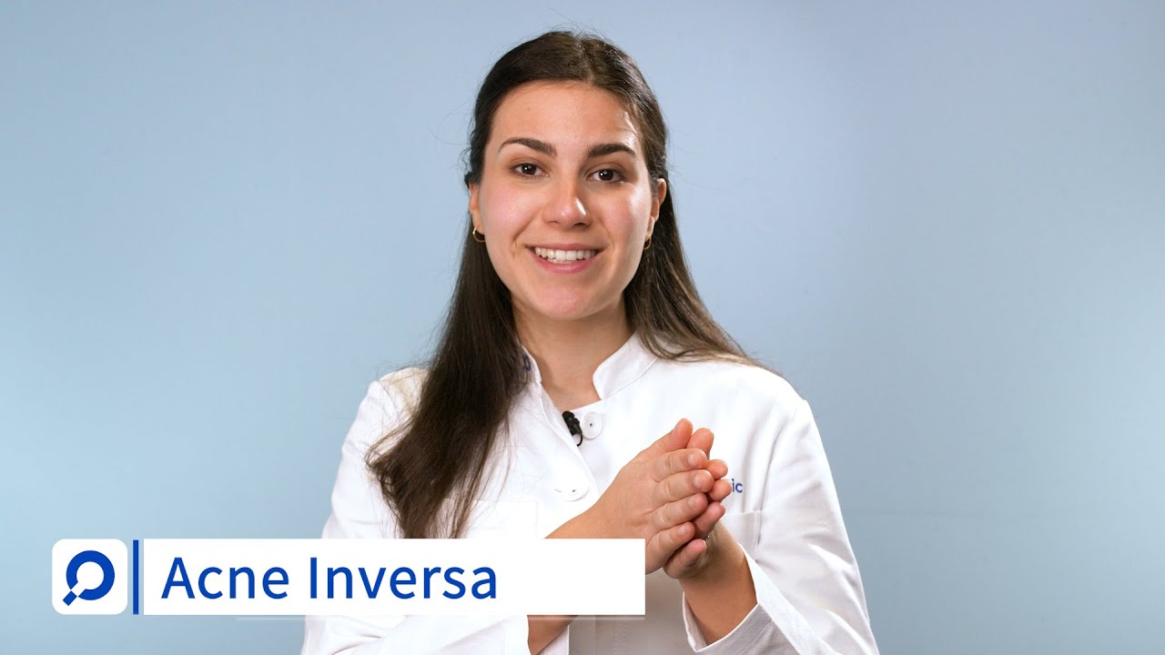 Akne inversa behandeln | dermanostic Hautlexikon