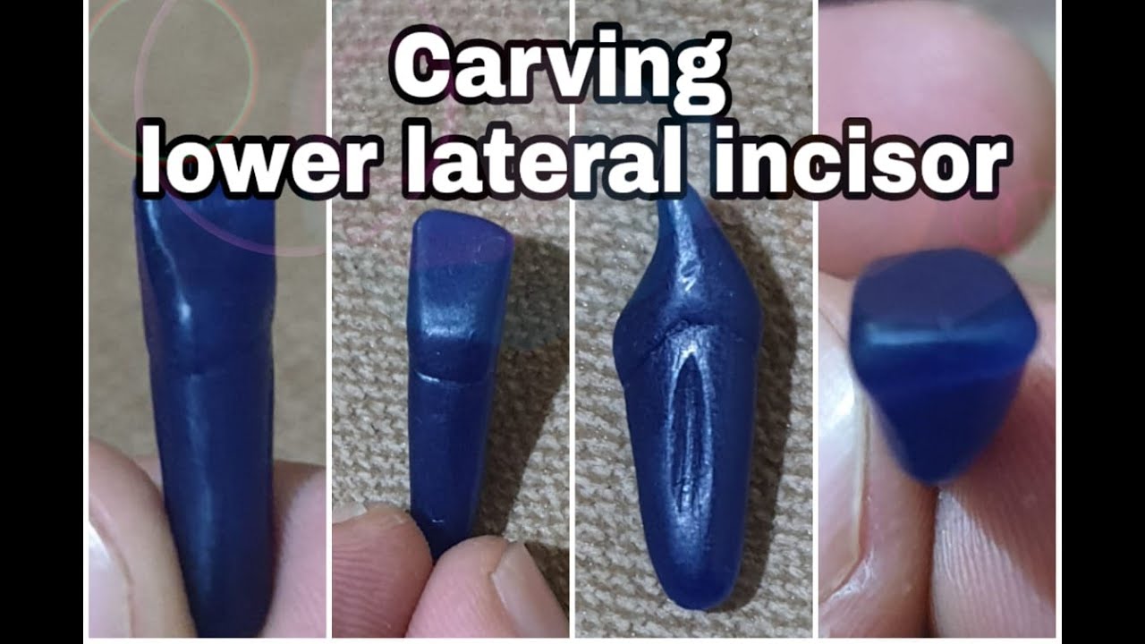 Carving lower lateral incisor ( في خمس دقائق فقط)