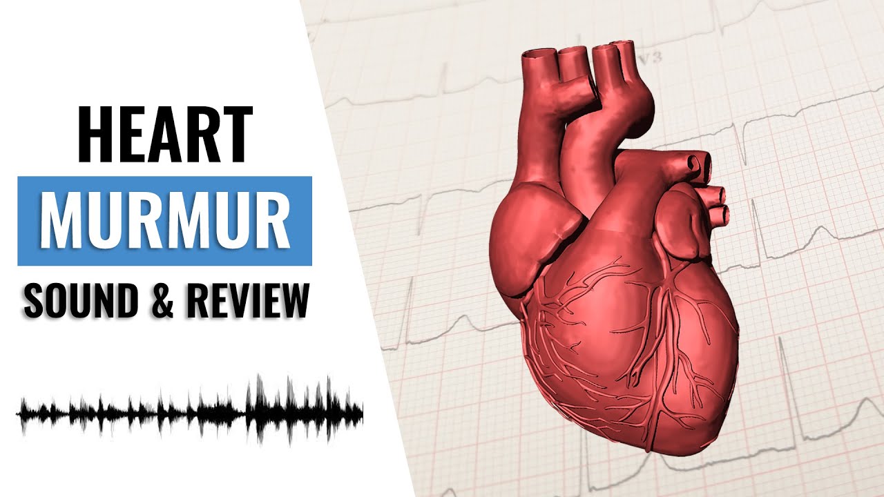 Heart Murmur Sounds | How to Identify a Heart Murmur |  3 Easy Steps to Identifying a Heart Murmur