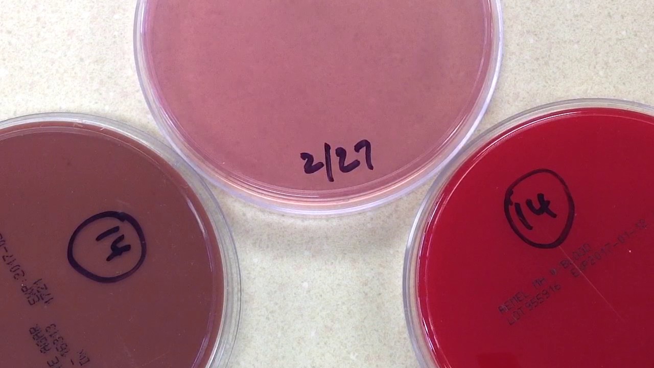 Plate Reading - Blood II