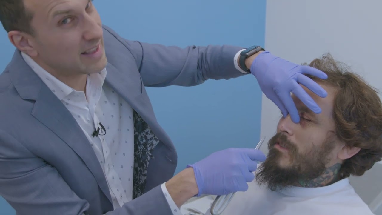 Facial Fractures