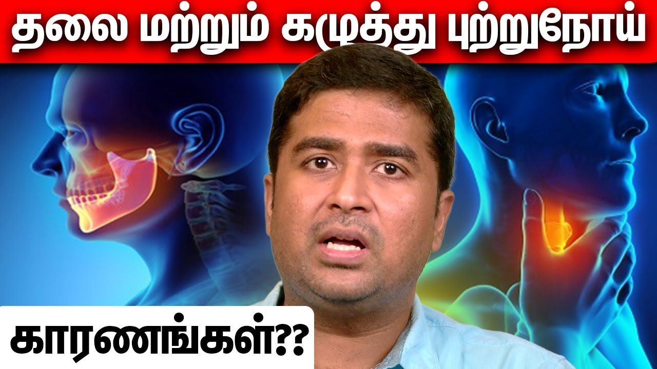 தலை மற்றும் கழுத்து புற்றுநோய் – காரணங்கள்?? | Dr Vignesh ENT