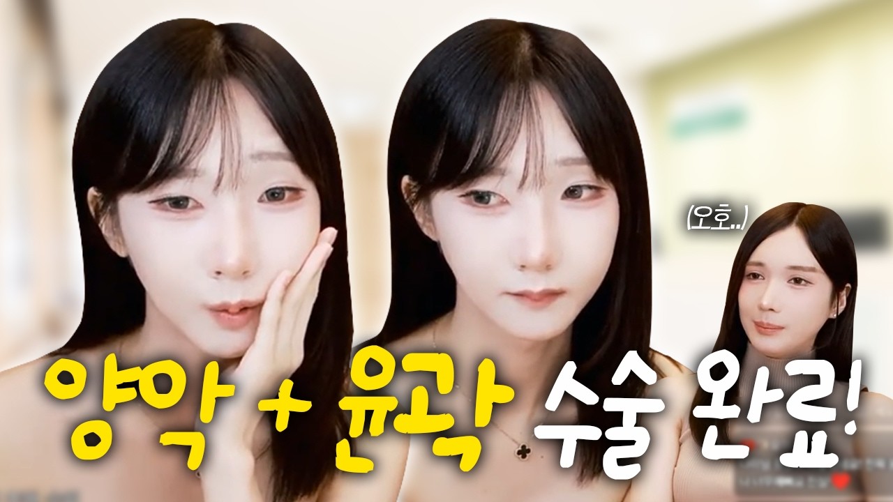 나미의 양악/윤곽 수술 결과! 🪞 수술 후 부작용은?