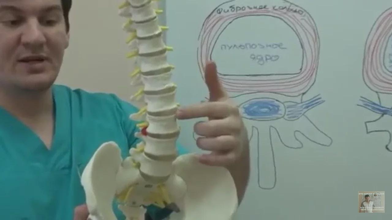 Soigne une hernie ou une protrusion — sans opération!