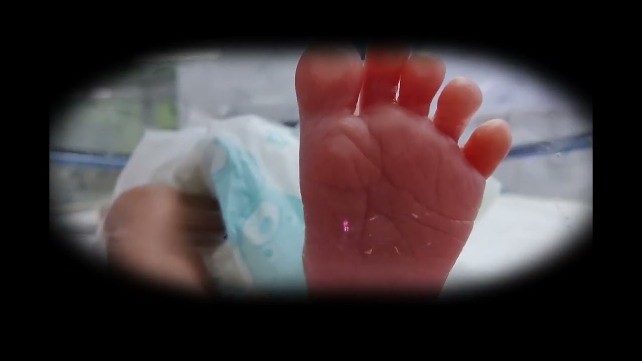 NICU dairies.#pretermbaby #pretermlabor #preterm