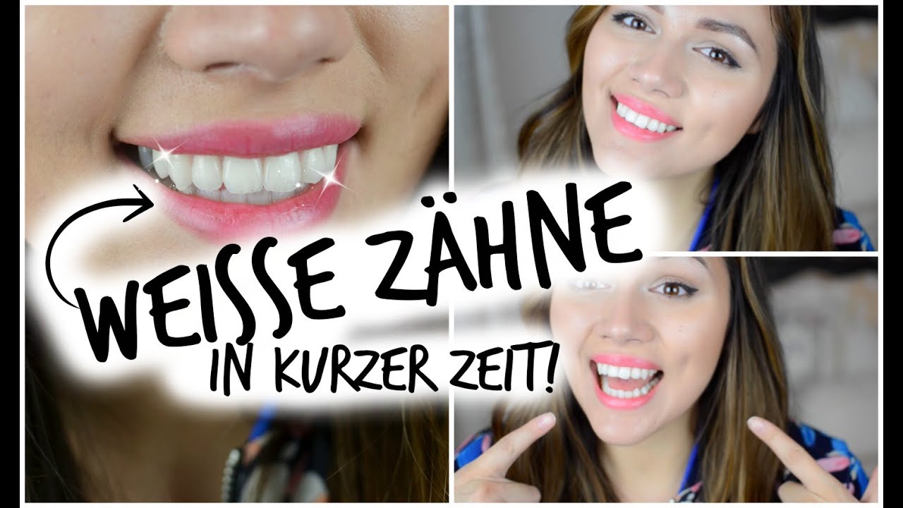 WEISSE ZÄHNE in KURZER ZEIT!