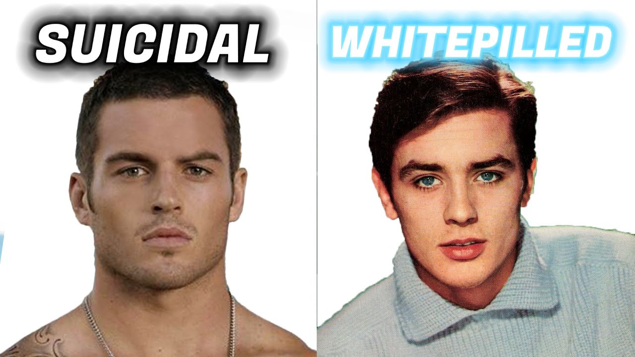 OptimismMaxxing - Blackpilled Moggers v WhitePilled Moggers