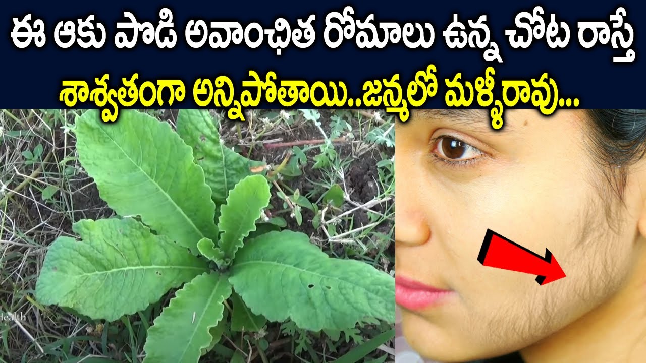 అవాంఛిత రోమాలు ఉన్న చోట ఇది రాస్తే శాశ్వతంగా అన్ని పోతాయి | unwanted hair on face remove permanently