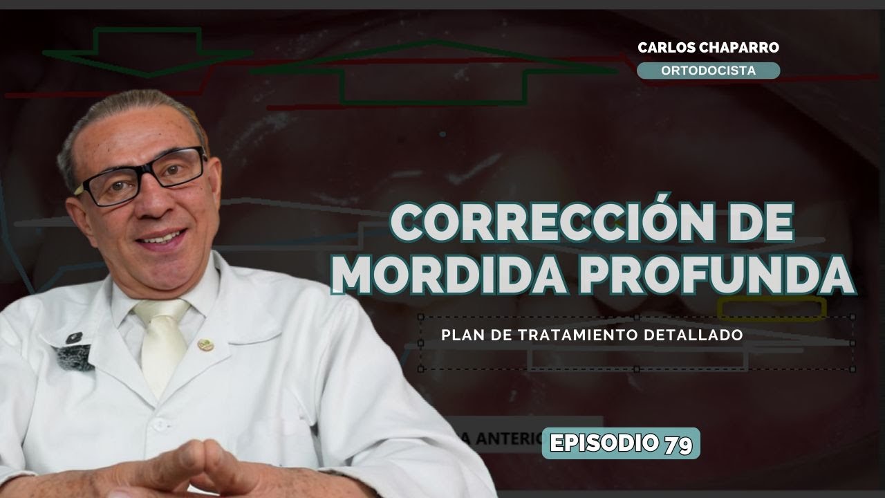 Corrección de mordida profunda - EPISODIO 79